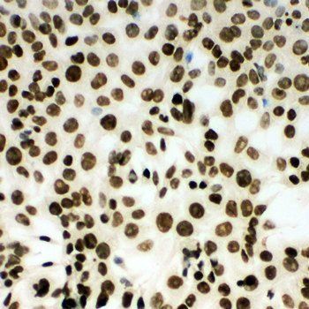 MCM2 Rabbit Polyclonal Antibody