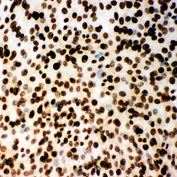 MCM2 Rabbit Polyclonal Antibody