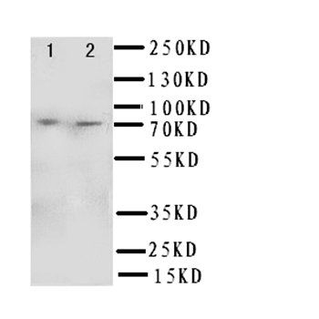 SDHA Rabbit Polyclonal Antibody