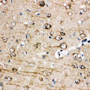 TRPC3 Rabbit Polyclonal Antibody