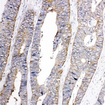 TRPC3 Rabbit Polyclonal Antibody