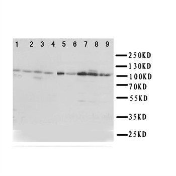 TRPC3 Rabbit Polyclonal Antibody