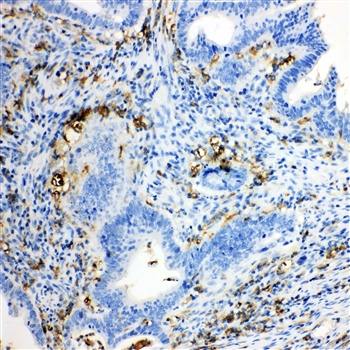 TRPC6 Rabbit Polyclonal Antibody