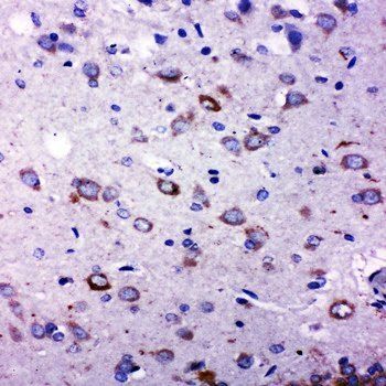 TRPC6 Rabbit Polyclonal Antibody