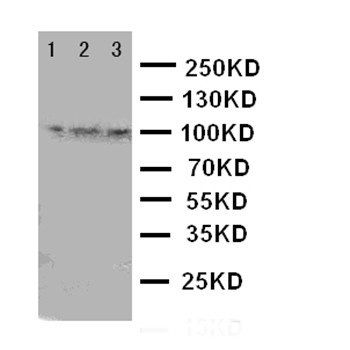 TRPC6 Rabbit Polyclonal Antibody