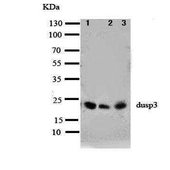DUSP3 Rabbit Polyclonal Antibody