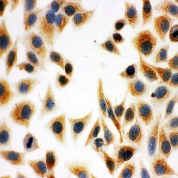 DCI/ECI1 Rabbit Polyclonal Antibody