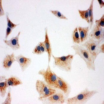 DCI/ECI1 Rabbit Polyclonal Antibody