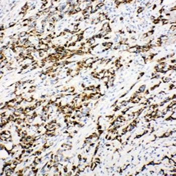 DCI/ECI1 Rabbit Polyclonal Antibody