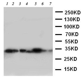 DCI/ECI1 Rabbit Polyclonal Antibody