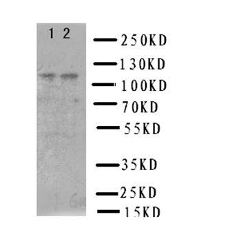Neuropilin-2 NRP2 Rabbit Polyclonal Antibody