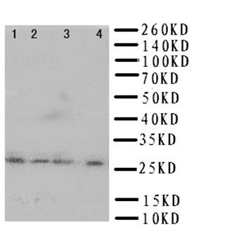 HLA DMB/HLA-DMB Rabbit Polyclonal Antibody
