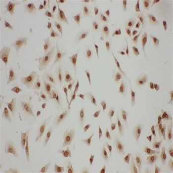 LIM and SH3 domain protein 1 LASP1 Rabbit Polyclonal Antibody