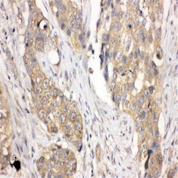 LIM and SH3 domain protein 1 LASP1 Rabbit Polyclonal Antibody