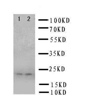 Prion protein PrP/PRNP Rabbit Polyclonal Antibody