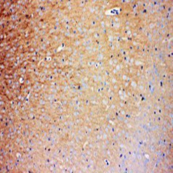 Prion protein PrP/PRNP Rabbit Polyclonal Antibody