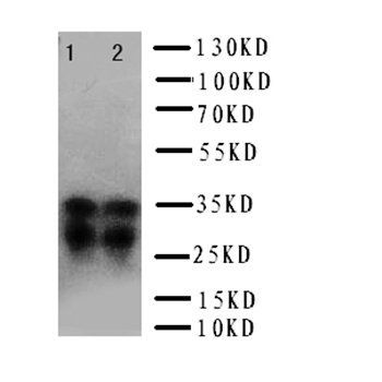 Prion protein PrP/PRNP Rabbit Polyclonal Antibody