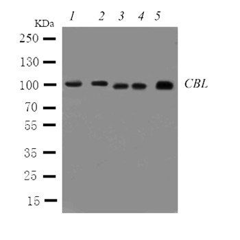 CBL Rabbit Polyclonal Antibody