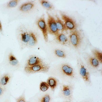 Hsp70/HSPA1A/HSPA1B Rabbit Polyclonal Antibody