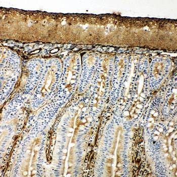 Hsp70/HSPA1A/HSPA1B Rabbit Polyclonal Antibody