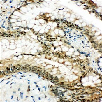 Hsp70/HSPA1A/HSPA1B Rabbit Polyclonal Antibody
