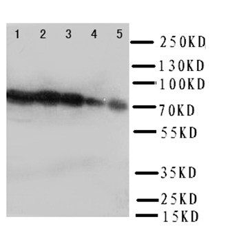 Hsp70/HSPA1A/HSPA1B Rabbit Polyclonal Antibody