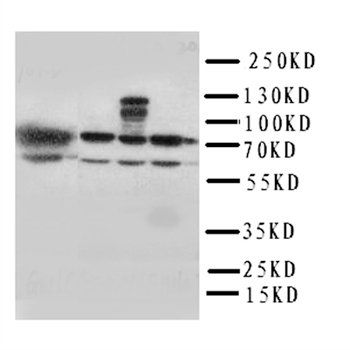 HSPA2 Rabbit Polyclonal Antibody
