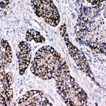Peroxiredoxin 3/PRDX3 Rabbit Polyclonal Antibody