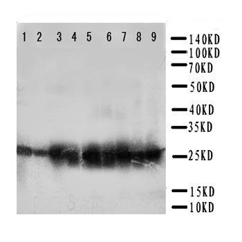 Peroxiredoxin 3/PRDX3 Rabbit Polyclonal Antibody