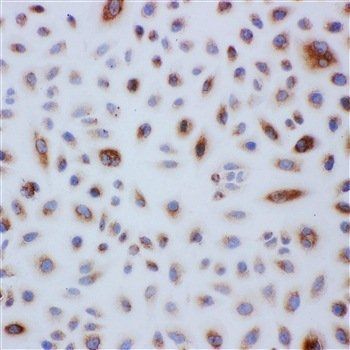 Peroxiredoxin 3/PRDX3 Rabbit Polyclonal Antibody