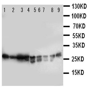 Peroxiredoxin 3/PRDX3 Rabbit Polyclonal Antibody