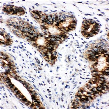 STAT5b Rabbit Polyclonal Antibody