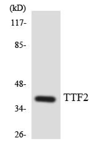 FoxE1 rabbit pAb Antibody