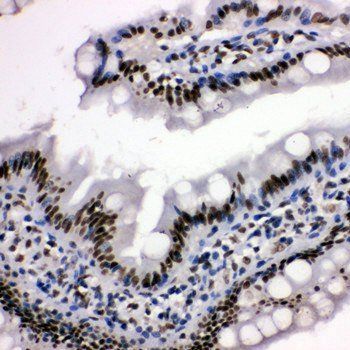Histone deacetylase 3 HDAC3 Rabbit Polyclonal Antibody