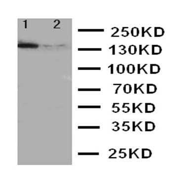 ErbB 4/ERBB4 Rabbit Polyclonal Antibody