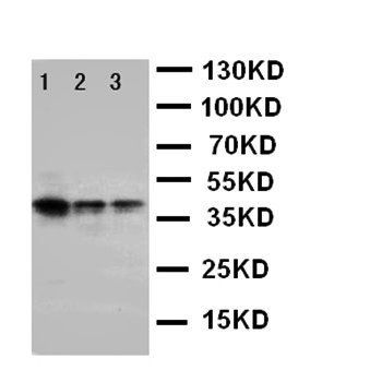 ErbB 4/ERBB4 Rabbit Polyclonal Antibody