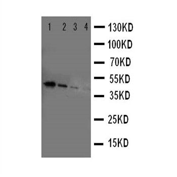 ErbB 4/ERBB4 Rabbit Polyclonal Antibody