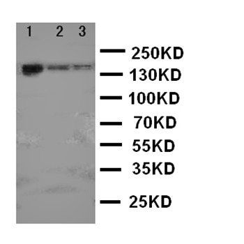 ErbB 4/ERBB4 Rabbit Polyclonal Antibody