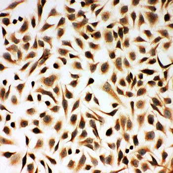 Smad2 Rabbit Polyclonal Antibody