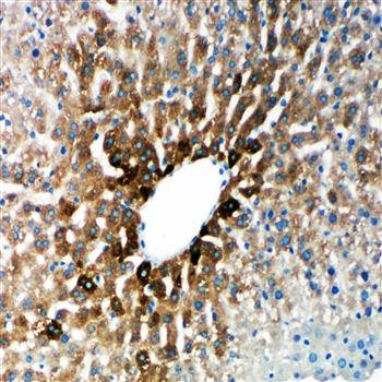 Cytochrome P450 2E1/CYP2E1 Rabbit Polyclonal Antibody
