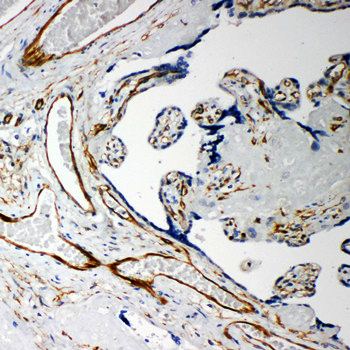 Iduronate 2 sulfatase/IDS Rabbit Polyclonal Antibody