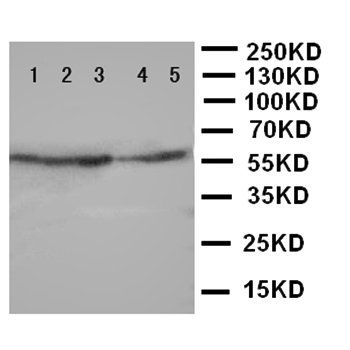 Iduronate 2 sulfatase/IDS Rabbit Polyclonal Antibody