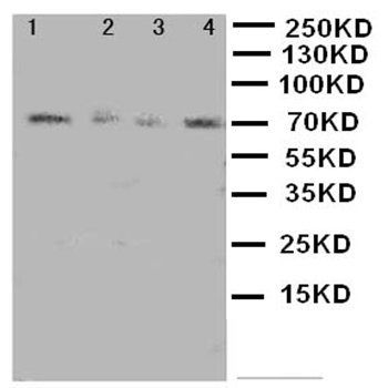 MEKK3/MAP3K3 Rabbit Polyclonal Antibody