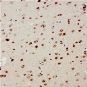 MEKK3/MAP3K3 Rabbit Polyclonal Antibody