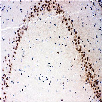 MEKK3/MAP3K3 Rabbit Polyclonal Antibody