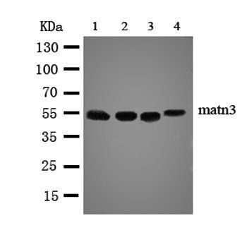 Matrilin 3/MATN3 Rabbit Polyclonal Antibody