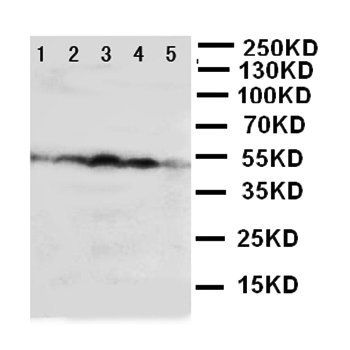 HSC70 Interacting Protein HIP/ST13 Rabbit Polyclonal Antibody