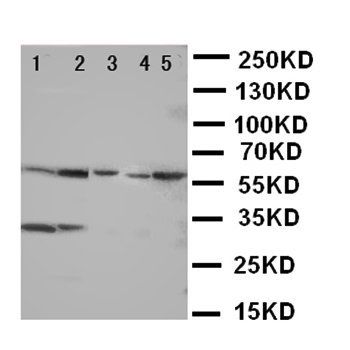 Acid-sensing ion channel 3 ASIC3 Rabbit Polyclonal Antibody