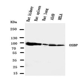 OSBP1 Rabbit Polyclonal Antibody