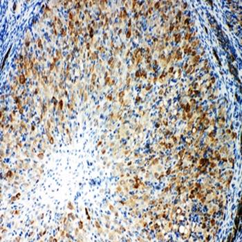 Cytochrome P450 Reductase/POR Rabbit Polyclonal Antibody